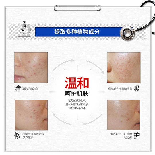 Крем для лечения акне и шрамов Anti-acne